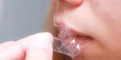 7 bước trị môi thâm nẻ với mật ong hiệu nghiệm ngay lần đầu áp dụng